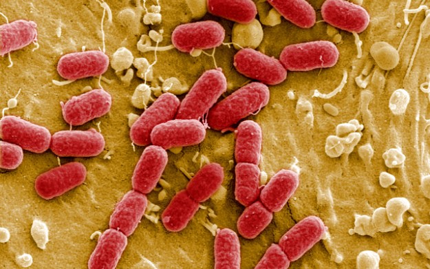 ecoli-ehec-bakterija ecoli-ehec-bakterija