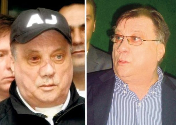 Halid Bešlić prije i poslije operacije Halid Bešlić prije i poslije operacije