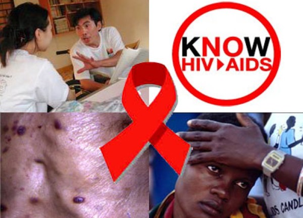 HIV AIDS HIV AIDS