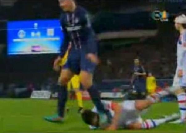 ibrahimovic noga