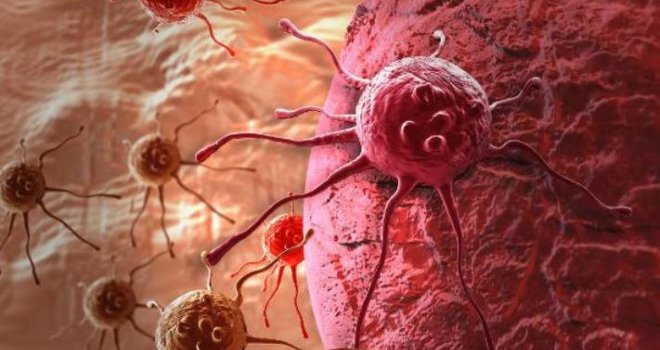 Stručnjaci: Ova namirnica uništava ćelije raka, efikasnija je od kemoterapije