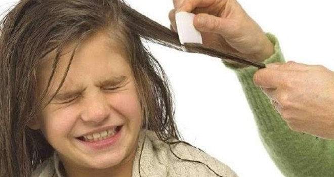 Nakon Sarajeva, i kod mnoge djece u RS pojavile se vaške