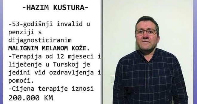 Hazim Kustura bori se sa malignim melanomom, jedini spas je terapija u Turskoj