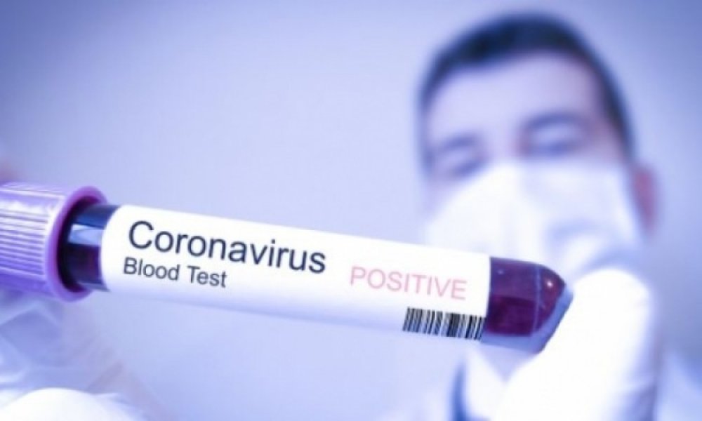 koronavirus-krv-testiranje