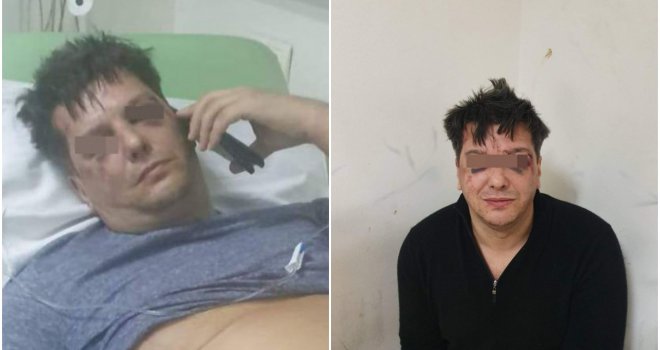 'Mislili su da sam umro pa su mi podmetnuli brašno': Biznismen iz Njujorka tvrdi da su ga u Bugojnu pretukli policajci