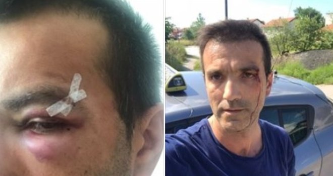 Pretučen ili se (sam) okliznuo: Sarajlija došao da se požali na lošu uslugu pa završio u krvavim modricama?!