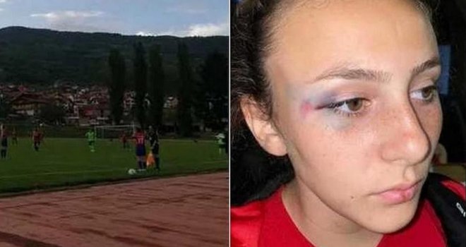 Masovna tuča na terenu: Potukle se bh. nogometašice, jedna završila s potresom mozga