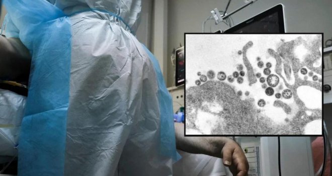 Opasni virus: Lassa groznica je stigla u Evropu - ovo je sve što morate znati o toj opakoj bolesti