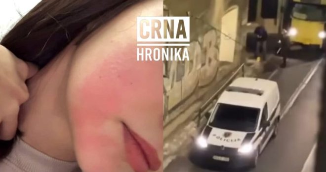 Šta se sinoć dešavalo u sarajevskom tramvaju? Djevojka tvrdi: 'Napali su nas suzavcem, tražili smo od vozača da otvori vrata'