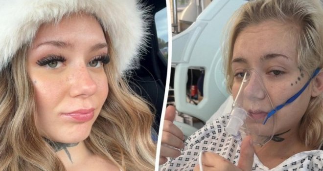 Djevojci (22) dijagnosticirali rijedak karcinom, pa shvatili da je krivac trend koji je eksplodirao kod mladih